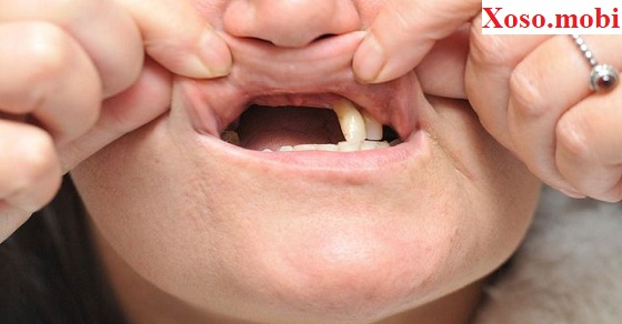 Ý nghĩa giấc mơ rụng răng Ý nghĩa giấc mơ rụng răng